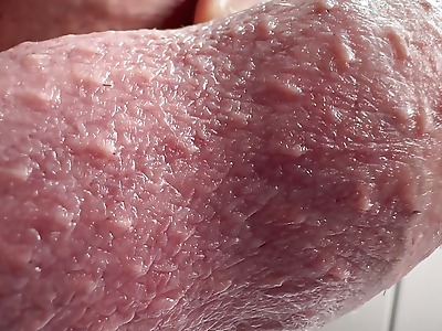 Penis Close-up penis increased